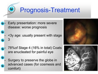 Prognosis-Treatment
• Early presentation: more severe
disease: worse prognosis
• <3y age: usually present with stage
3
• 78%of Stage 4 (16% in total) Coats
are enucleated for painful eye
• Surgery to preserve the globe in
advanced cases (for cosmesis and
comfort)
 
