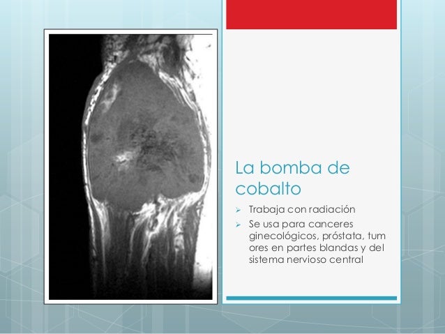 Los problemas del cuero cabelludo la caída de los cabello