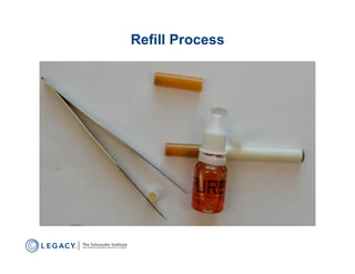 Refill Process
 