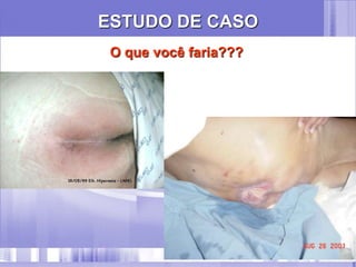 ESTUDO DE CASO
O que você faria???
 