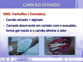 OBS: Carboflex ( Convatec)
 Carvão ativado + alginato
 Camada absorvente em contato com o exsudato,
forma gel macio e o carvão elimina o odor
CARVÃO ATIVADO
 