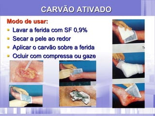 CARVÃO ATIVADO
Modo de usar:
 Lavar a ferida com SF 0,9%
 Secar a pele ao redor
 Aplicar o carvão sobre a ferida
 Ocluir com compressa ou gaze
 