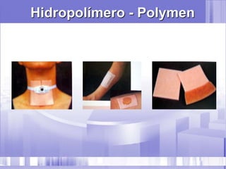 Hidropolímero - Polymen
 
