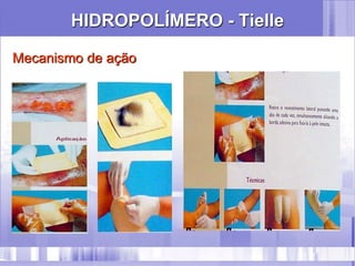 HIDROPOLÍMERO - Tielle
Mecanismo de ação
 