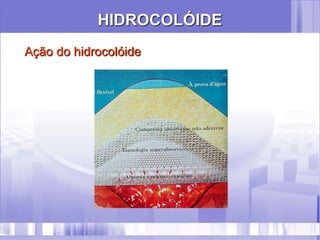 HIDROCOLÓIDE
Ação do hidrocolóide
 
