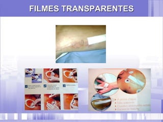 FILMES TRANSPARENTES
 