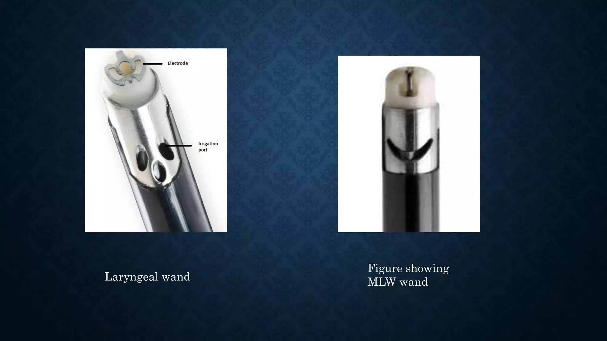 Laryngeal wand
Figure showing
MLW wand
 
