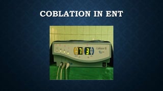 COBLATION IN ENT
 