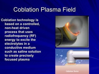 Coblation Plasma Field
Coblation technology is
  based on a controlled,
  non-heat driven
  process that uses
  radiofrequ...