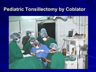 Pediatric Tonsillectomy by Coblator
 