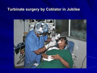 Turbinate surgery by Coblator in Jubilee
 