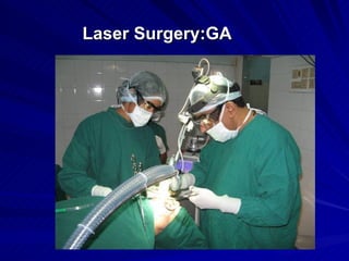Laser Surgery:GA
 