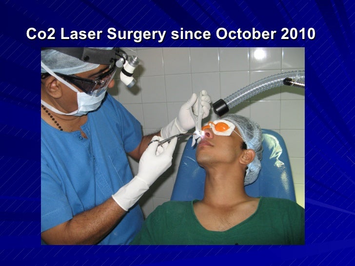 Coblator and laser surgery in ENTJubilee Hospital, Trivandrum, south…