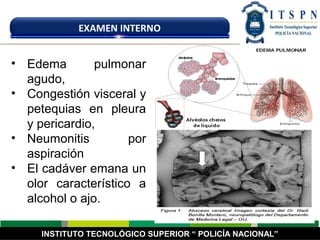 INSTITUTO TECNOLÓGICO SUPERIOR “ POLICÍA NACIONAL”
EXAMEN INTERNO
• Edema pulmonar
agudo,
• Congestión visceral y
petequias en pleura
y pericardio,
• Neumonitis por
aspiración
• El cadáver emana un
olor característico a
alcohol o ajo.
 