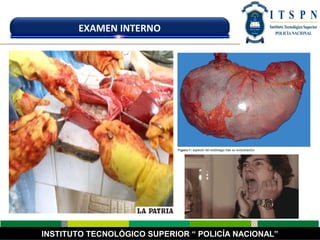 INSTITUTO TECNOLÓGICO SUPERIOR “ POLICÍA NACIONAL”
EXAMEN INTERNO
 