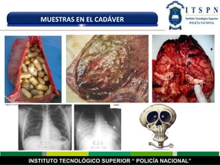 INSTITUTO TECNOLÓGICO SUPERIOR “ POLICÍA NACIONAL”
MUESTRAS EN EL CADÁVER
 