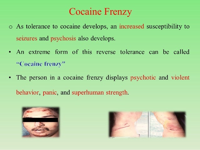 levamisole cocaine symptoms