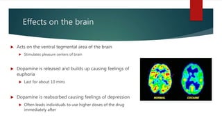 Effects on the brain
 Acts on the ventral tegmental area of the brain
 Stimulates pleasure centers of brain
 Dopamine is released and builds up causing feelings of
euphoria
 Last for about 10 mins
 Dopamine is reabsorbed causing feelings of depression
 Often leads individuals to use higher doses of the drug
immediately after
 