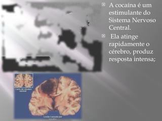  A cocaína é um
estimulante do
Sistema Nervoso
Central.
 Ela atinge
rapidamente o
cérebro, produz
resposta intensa;
 