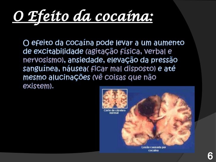 Cocaína carlos e patricia 6ºe