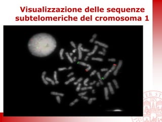 Visualizzazione delle sequenze
subtelomeriche del cromosoma 1
 