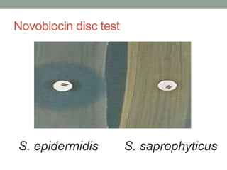 Novobiocin disc test




S. epidermidis         S. saprophyticus
 