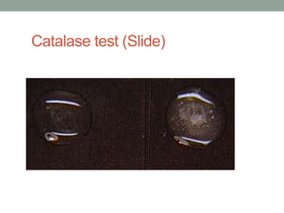 Catalase test (Slide)




Negative                Positive
 