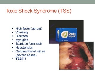 Toxic Shock Syndrome (TSS)


  • High fever (abrupt)
  • Vomiting
  • Diarrhea
  • Myalgias
  • Scarlatiniform rash
  • Hypotension
  • Cardiac/Renal failure
    (severe cases)
  • TSST-1
 