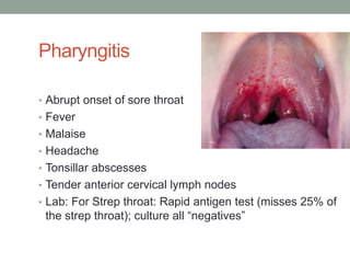 Pharyngitis

• Abrupt onset of sore throat
• Fever
• Malaise
• Headache
• Tonsillar abscesses
• Tender anterior cervical lymph nodes
• Lab: For Strep throat: Rapid antigen test (misses 25% of
 the strep throat); culture all “negatives”
 