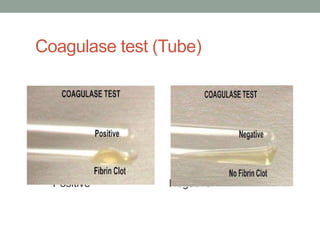 Coagulase test (Tube)




  Positive      Negative
 