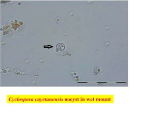 Cyclospora cayetanensis oocyst in wet mount
 
