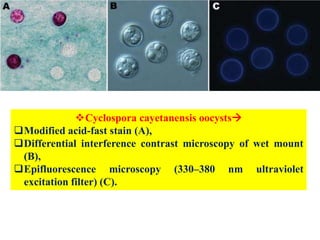 Cyclospora cayetanensis oocysts
Modified acid-fast stain (A),
Differential interference contrast microscopy of wet mount
(B),
Epifluorescence microscopy (330–380 nm ultraviolet
excitation filter) (C).
 
