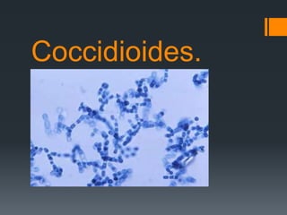 Coccidioides.
 