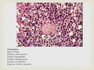 Taxonomía.
Reino: Fungi
Phylum: Ascomycota
Orden: Onygenales
Familia: Onygenaceae
Género: Coccidioides.
Especies: immitis, posadasii
 