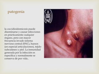 patogenia
la coccidioidomicosis puede
diseminarse y causar infecciones
en prácticamente cualquier
órgano, pero con mayor
frecuencia invade sistema
nervioso central (SNC), huesos
(en especial articulaciones), tejido
subcutáneo y piel. La inmunidad
generada por la infección es
específica y normalmente se
conserva de por vida..
 