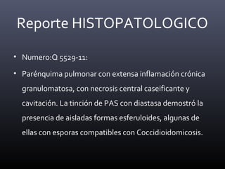 • Numero:Q 5529-11:
• Parénquima pulmonar con extensa inflamación crónica
granulomatosa, con necrosis central caseificante y
cavitación. La tinción de PAS con diastasa demostró la
presencia de aisladas formas esferuloides, algunas de
ellas con esporas compatibles con Coccidioidomicosis.
Reporte HISTOPATOLOGICO
 