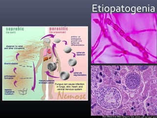 Rev Med Inst Mex Seguro Soc 2010; 48 (4):447-452
Etiopatogenia
 