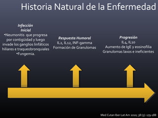 Historia Natural de la Enfermedad
Infección
Inicial
•Neumonitis que progresa
por contigüidad y luego
invade los ganglios linfáticos
hiliares e traqueobronquiales
•Fungemia.
Respuesta Humoral
IL2, IL12, INF-gamma
Formación de Granulomas
Progresión
IL4, IL10
Aumento de IgE y eosinofilia
Granulomas laxos e ineficientes
Med Cutan Iber Lat Am 2010; 38 (5): 179-188
 