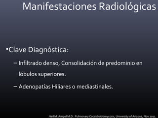 Manifestaciones Radiológicas
•Clave Diagnóstica:
– Infiltrado denso, Consolidación de predominio en
lóbulos superiores.
– Adenopatías Hiliares o mediastinales.
Neil M. Ampel M.D. Pulmonary Coccidioidomycosis, University of Arizona, Nov 2011.
 