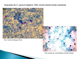 Ooquistes de C. parvum (objetivo 10X), tinción alcohol ácido resistente




Foto: Tamara Velásquez Porta




                                              Foto cortesía de: José Guillermo Carrillo Paredes
 