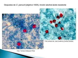 Ooquistes de C. parvum (objetivo 100X), tinción alcohol ácido resistente




                                               Foto cortesía de: José Guillermo Carrillo Paredes




               Foto: Tamara Velásquez Porta
 