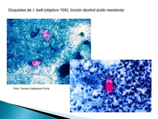 Ooquistes de I. belli (objetivo 10X), tinción alcohol ácido resistente




   Foto: Tamara Velásquez Porta
 
