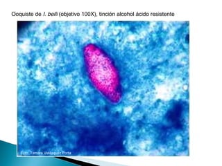 Ooquiste de I. belli (objetivo 100X), tinción alcohol ácido resistente




   Foto: Tamara Velásquez Porta
 