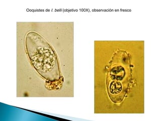 Ooquistes de I. belli (objetivo 100X), observación en fresco
 