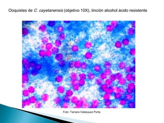 Ooquistes de C. cayetanensis (objetivo 10X), tinción alcohol ácido resistente




                              Foto: Tamara Velásquez Porta
 