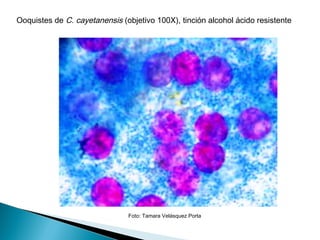 Ooquistes de C. cayetanensis (objetivo 100X), tinción alcohol ácido resistente




                               Foto: Tamara Velásquez Porta
 
