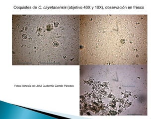 Ooquistes de C. cayetanensis (objetivo 40X y 10X), observación en fresco




Fotos cortesía de: José Guillermo Carrillo Paredes
 