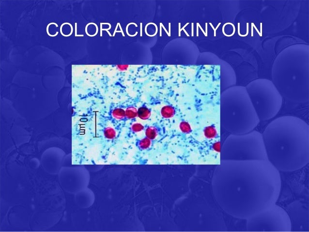COLORACION DE KINYOUN EPUB DOWNLOAD COLORACION DE KINYOUN EPUB DOWNLOAD