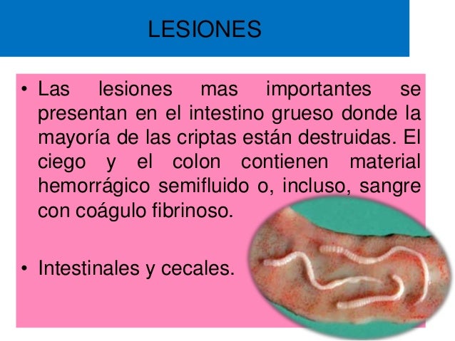 Como luchar con los parásitos en el apartamento