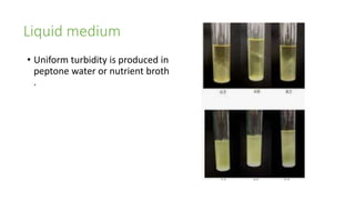 Liquid medium
• Uniform turbidity is produced in
peptone water or nutrient broth
.
 